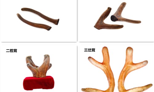 一岁踮脚走正常吗-一岁宝宝 踮脚 脚掌能放下网 - 一岁宝宝 踮脚 脚掌能放下去吗,一岁宝宝走路踮脚尖